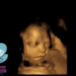3D ultrasound baby