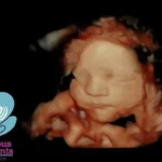 Ultrasound Baby HD Live